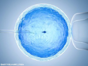 妇科微创
